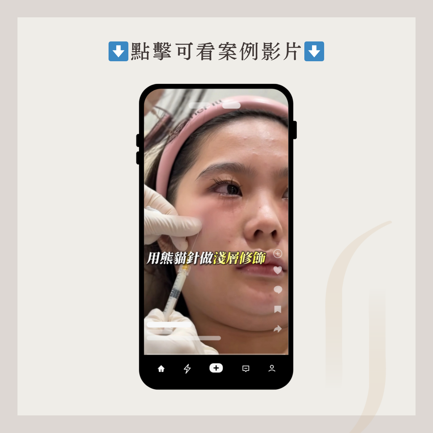 熊貓針案例2